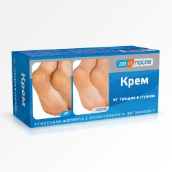 Крем для ног До и после от трещин в ступнях 50 мл